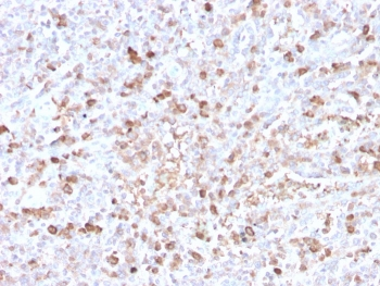 Lambda Light Chain Antibody / Lambda Antibody