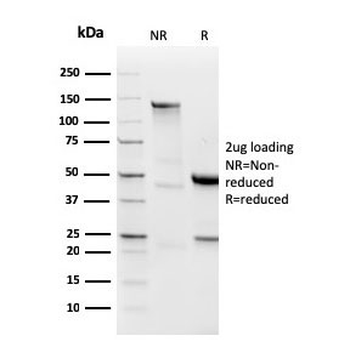 Lambda Light Chain Antibody / Lambda Antibody