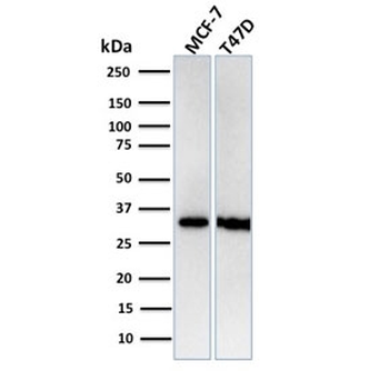 Recombinant RPA32 Antibody / Replication Protein A2