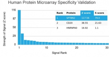 SPTBN2 Antibody / Spectrin beta III