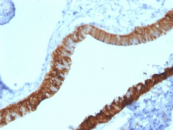 Cytokeratin 3 Antibody / KRT3