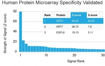 Cytokeratin 3 Antibody / KRT3