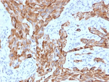 KRT7 Antibody / Cytokeratin 7