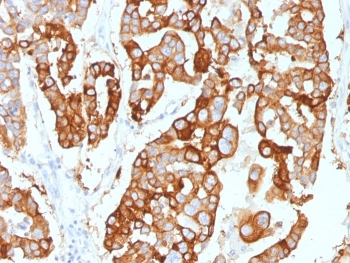 KRT7 Antibody / Cytokeratin 7