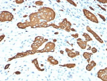 KRT8 Antibody / Cytokeratin 8