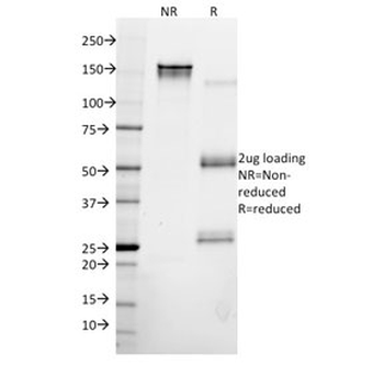 KRT8 Antibody / Cytokeratin 8