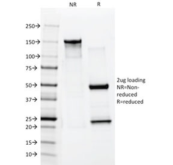 KRT10 Antibody / Cytokeratin 10