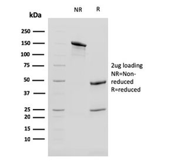 Cytokeratin 13 Antibody / KRT13