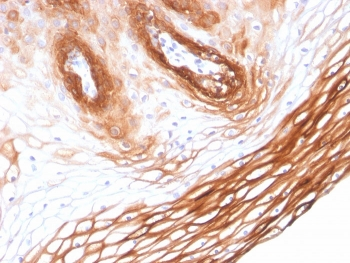 Cytokeratin 14 Antibody / CK14 / KRT14