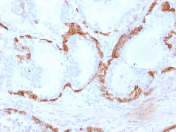 Cytokeratin 14 Antibody / CK14 / KRT14
