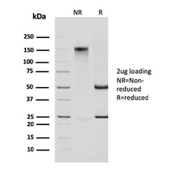 Cytokeratin 14 Antibody / CK14 / KRT14