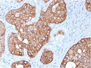 KRT15 Antibody / Cytokeratin 15