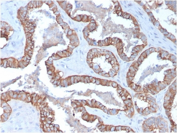 KRT15 Antibody / Cytokeratin 15