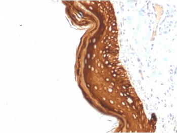 KRT15 Antibody / Cytokeratin 15