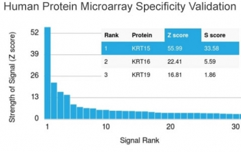 KRT15 Antibody / Cytokeratin 15