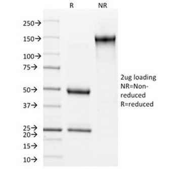 KRT15 Antibody / Cytokeratin 15