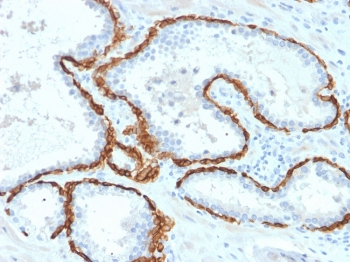 KRT15 Antibody / Cytokeratin 15