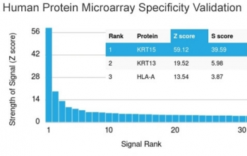KRT15 Antibody / Cytokeratin 15