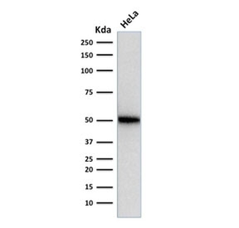 p53 Antibody / TP53