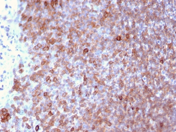 LSP1 Antibody / Lymphocyte Specific Protein 1