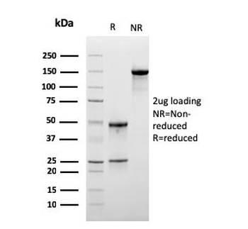 LSP1 Antibody / Lymphocyte Specific Protein 1