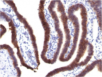 EpCAM Antibody