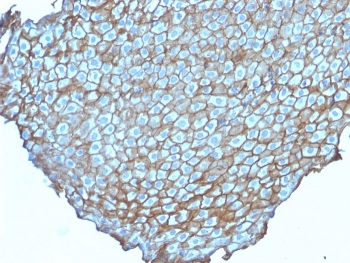 Desmoglein 3 Antibody / DSG3