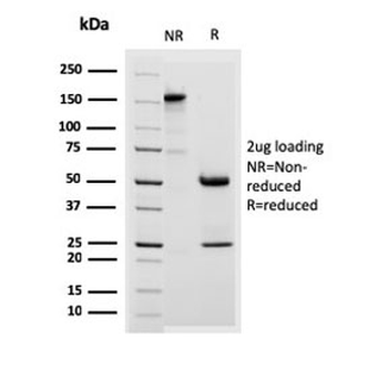 Desmoglein 3 Antibody / DSG3