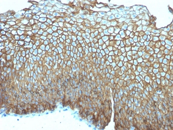 Desmoglein 3 Antibody / DSG3