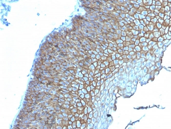 Desmoglein 3 Antibody / DSG3