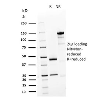 Desmoglein 3 Antibody / DSG3