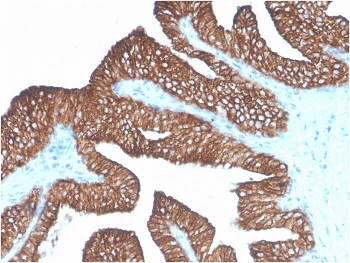 EpCAM Antibody