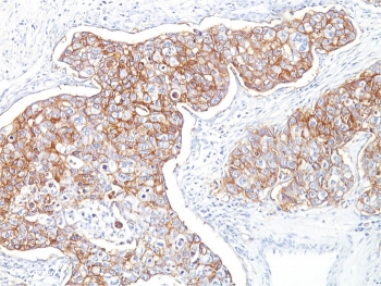 EpCAM Antibody
