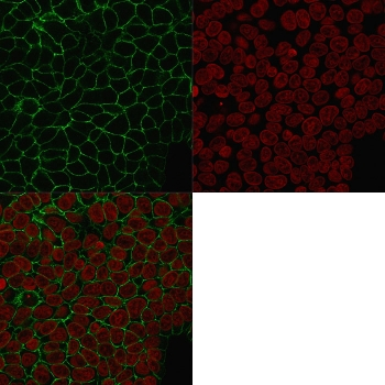 EpCAM Antibody