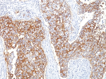 EpCAM Antibody