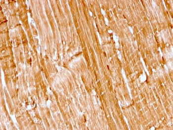 Recombinant Myoglobin Antibody
