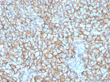 CD146 Antibody / MCAM / MUC18
