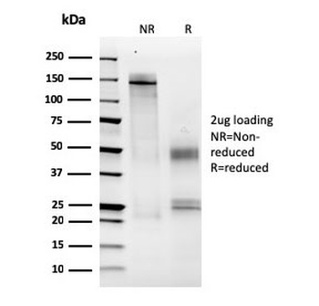 MCM6 Antibody