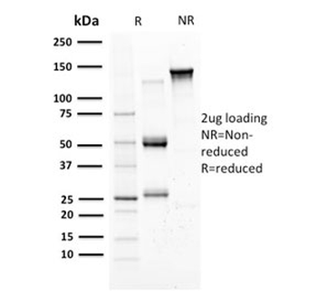 Mammaglobin A Antibody / SCGB2A2