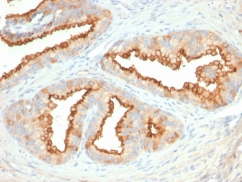 CD10 Antibody / Neprilysin