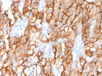 CD10 Antibody / Neprilysin