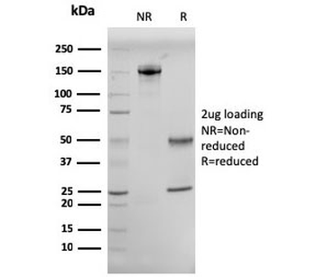 CD10 Antibody / Neprilysin