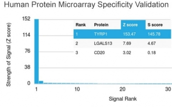 TRP1 / Tyrosinase-Related Protein-1 Antibody