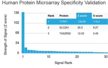 TRP1 / Tyrosinase-Related Protein-1 Antibody