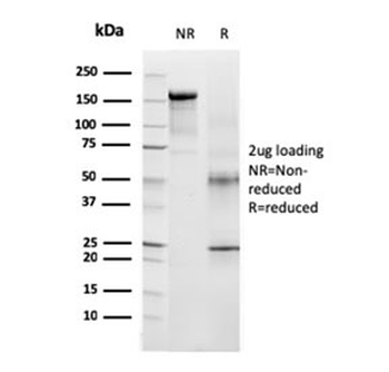 TRP1 / Tyrosinase-Related Protein-1 Antibody
