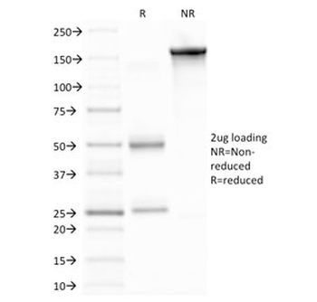 MMP9 Antibody / Matrix metalloproteinase-9