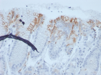 MUC2 Antibody / Mucin 2