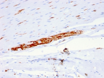 NCAM / CD56 Antibody