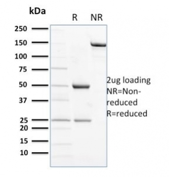 NCAM / CD56 Antibody