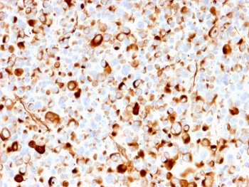 NGF Receptor Antibody / p75NTR / CD271